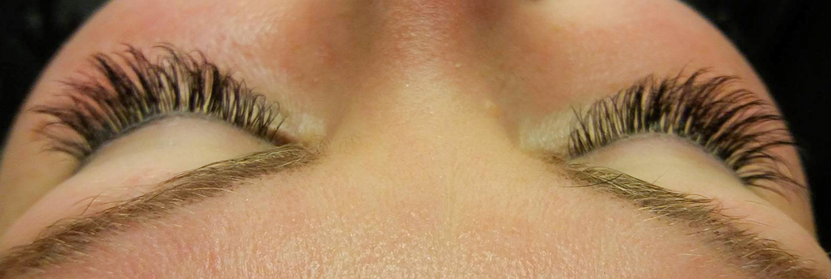 jälkeen kuva